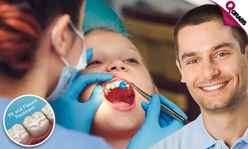 Dental Services: Fluoride Application OR Pit & Fissure Treatment!
